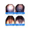 Cappucci di crescita dei capelli del laser a diodi 5mW della classe II per perdita di capelli